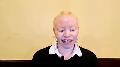 Under The Same Sun Fund, Ms. Gift Sakala
