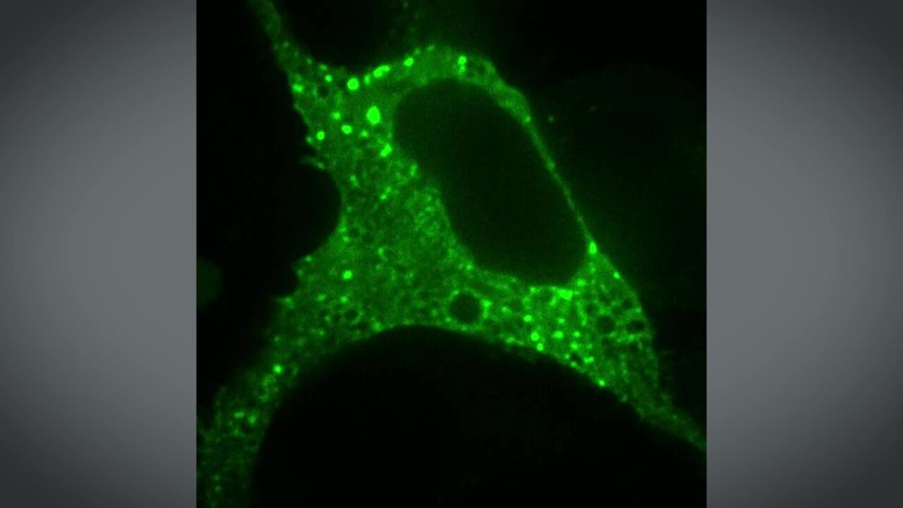 WNKs in Phase Separation