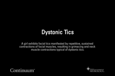 Dystonic tics