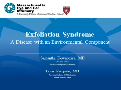 Exfoliation syndrome: a disease with an environmental component