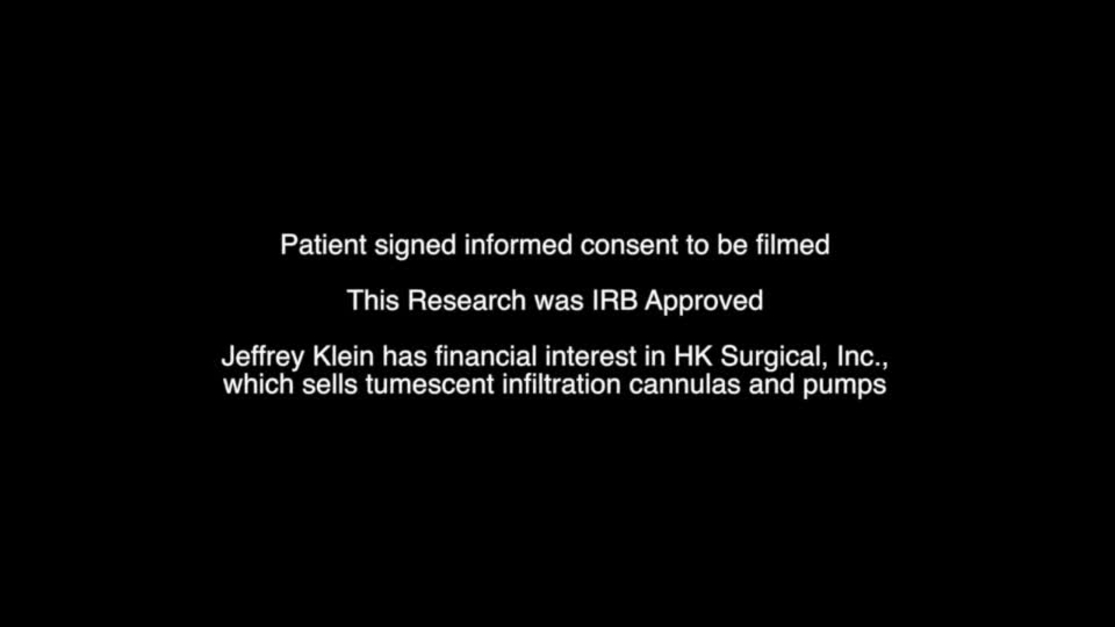 Plastic and Reconstructive Surgery Global Open