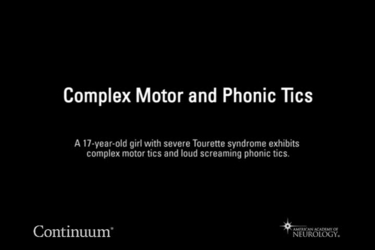 Complex motor and phonic tics