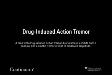 Drug-induced action tremor