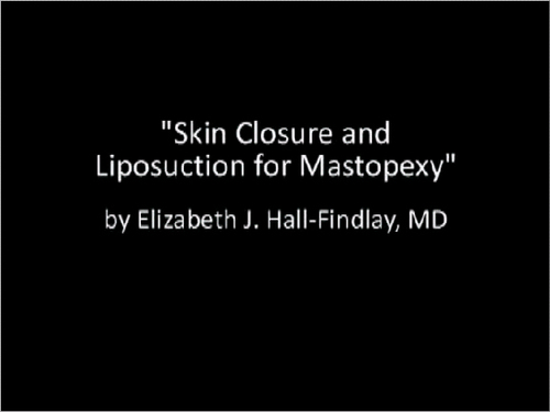 Abdominoplasty - Banff Plastic Surgery- Dr. Elizabeth Hall-Findlay, MD,  FRCSC