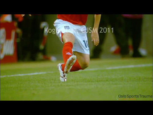 Raw video at time of injury taken with high-definition, high-speed camera.