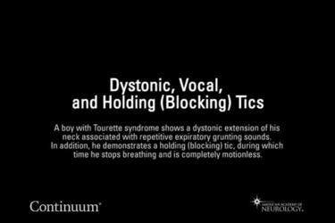 Dystonic, vocal, and holding (blocking) tics