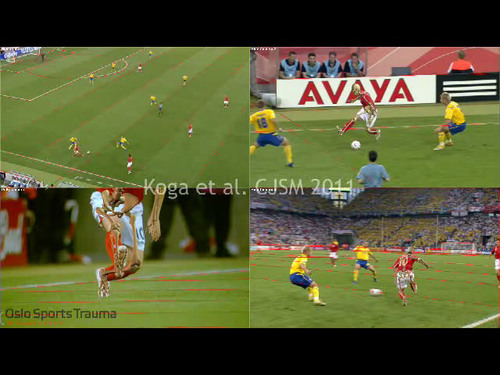 Matched video at time of injury using model-based image-matching technique.