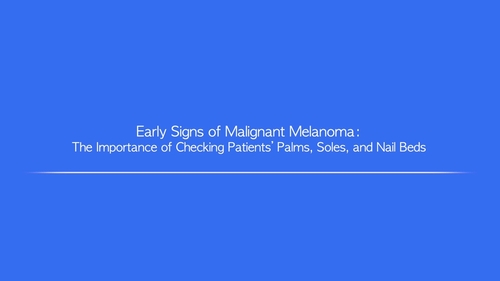 Early Signs of Malignant Melanoma: The Importance of Checking Patients’ Palms, Soles, and Nail Beds