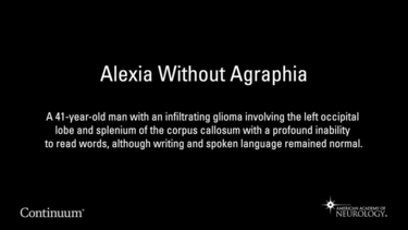 Alexia Without Agraphia