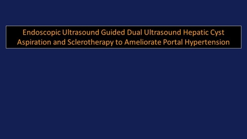 EUS Dual Ultrasound hepatic cyst aspiration and sclerotherapy