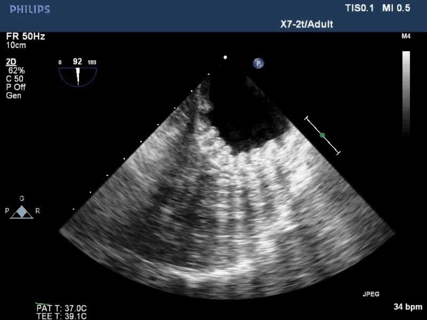 Anesthesia & Analgesia