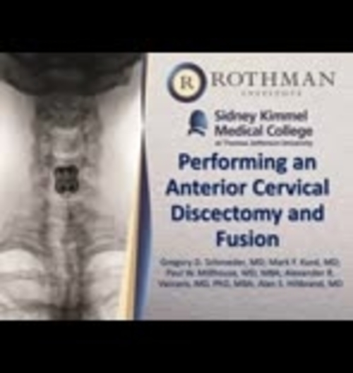 Performing an Anterior Cervical Discectomy and Fusion