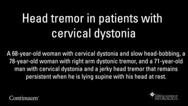 Head tremor in patients with cervical dystonia