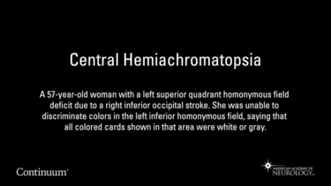 Central Hemiachromatopsia