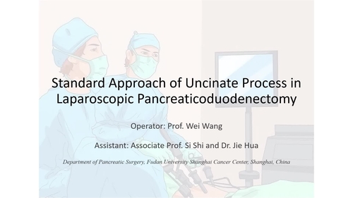 Uncinate Resection During Laparoscopic Pancreaticoduodenectomy