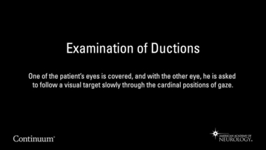 Examination of Ductions