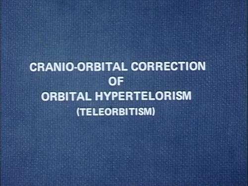 Orbital Hypertelorism