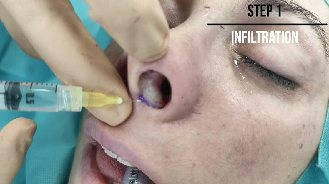 Plastic and Reconstructive Surgery