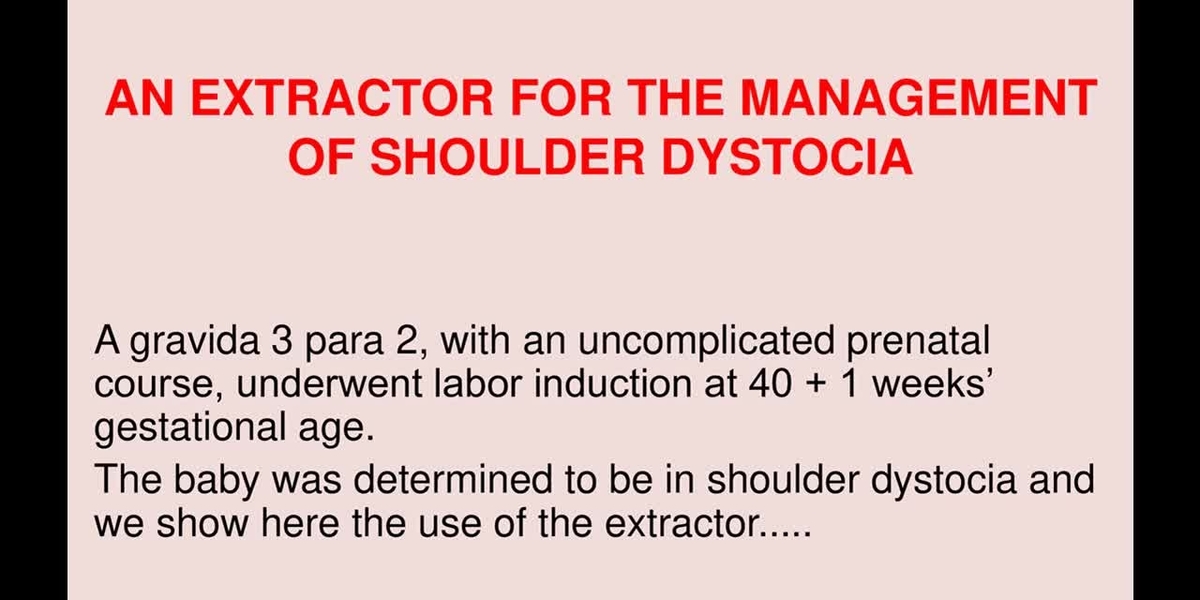 shoulder dystocia management