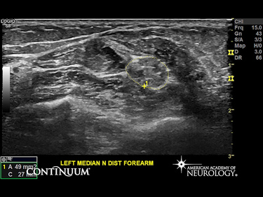 CONTINUUM: Lifelong Learning in Neurology