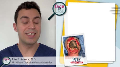 PRMA Plastic Surgery on X: #BreastReconstruction may not be for you, but  that doesn't mean you shouldn't discuss your options with a board-certified  plastic surgeon! Discussing flat closure & scar revision options