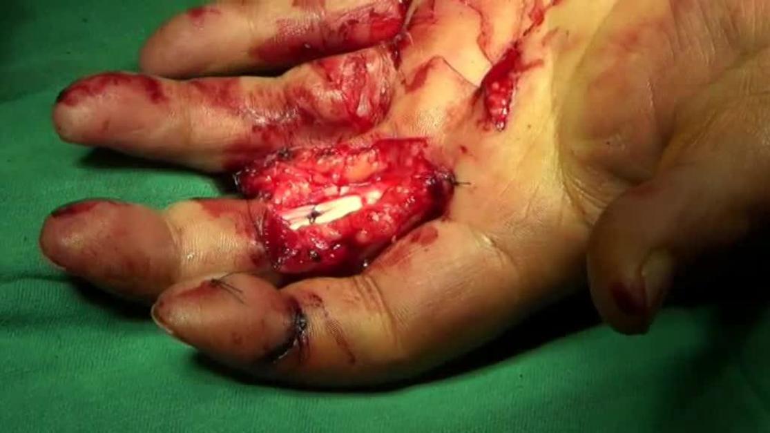 Plastic and Reconstructive Surgery