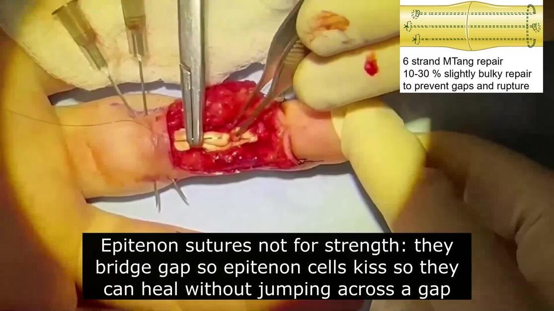 Plastic and Reconstructive Surgery – Global Open