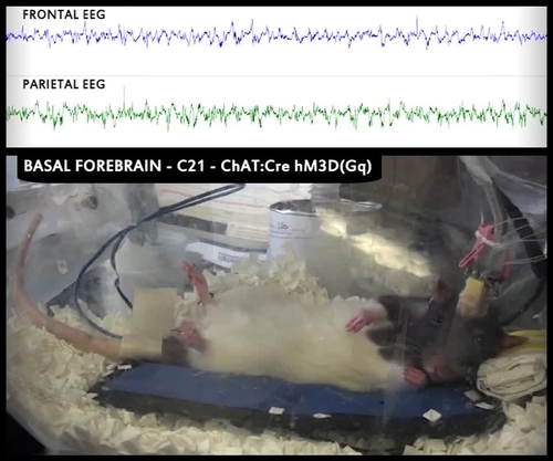 Chemogenetic stimulation of basal forebrain cholinergic neurons via local dialysis delivery of Compound 21 in sevoflurane-anesthetized female ChAT-Cre rat produced behavioral arousal.