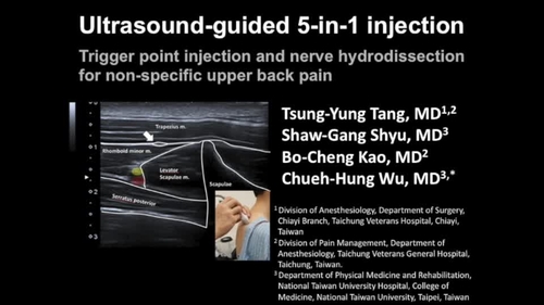 Ultrasound-guided 5-in-1 injection: trigger point injections and nerve hydrodissections for non-specific upper back pain