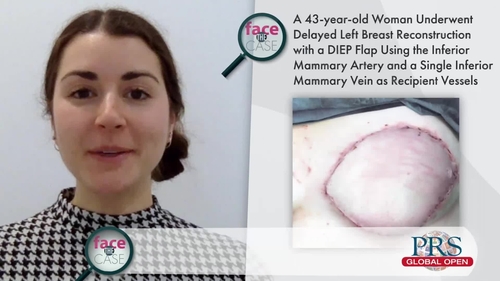 Breast Reconstruction with DIEP Flap - A/Prof Damian Marucci