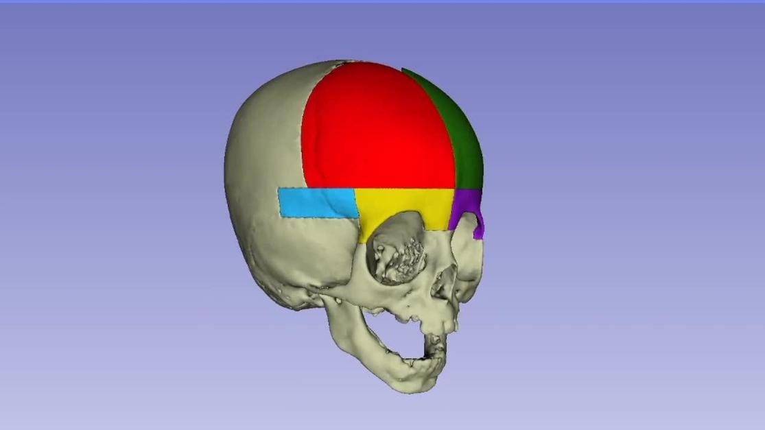 Plastic and Reconstructive Surgery Global Open