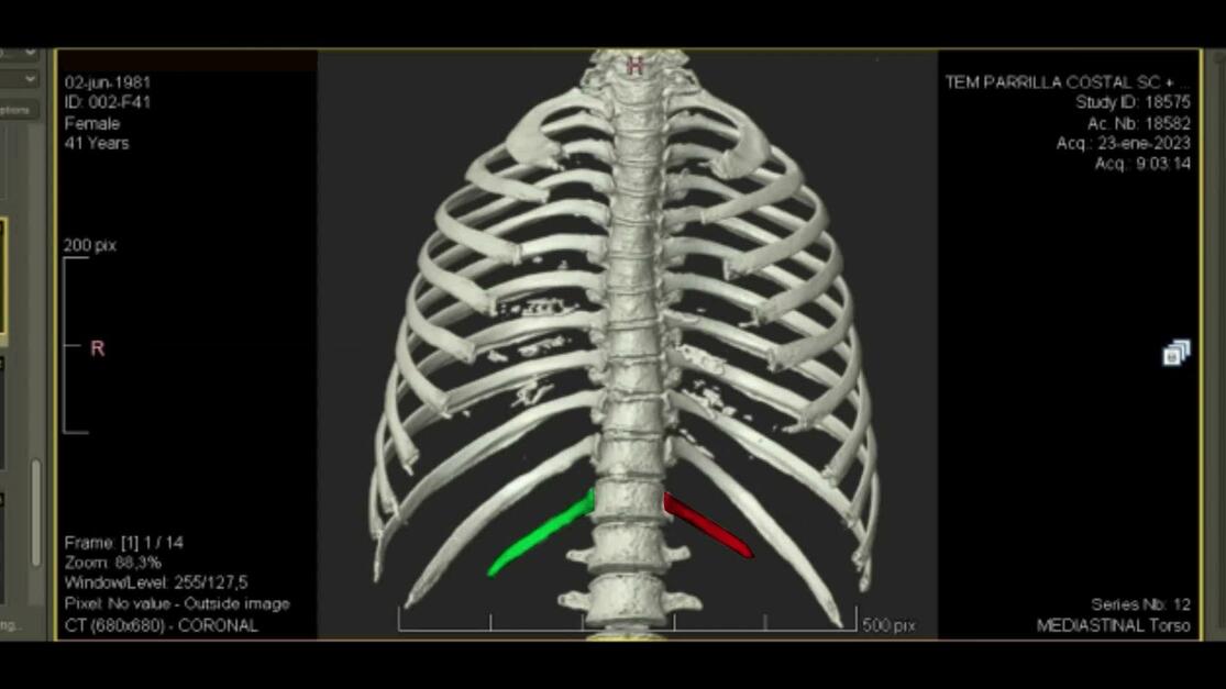Plastic and Reconstructive Surgery – Global Open