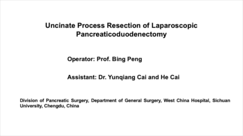 Uncinate Process Resection of Laparoscopic Pancreaticoduodenectomy