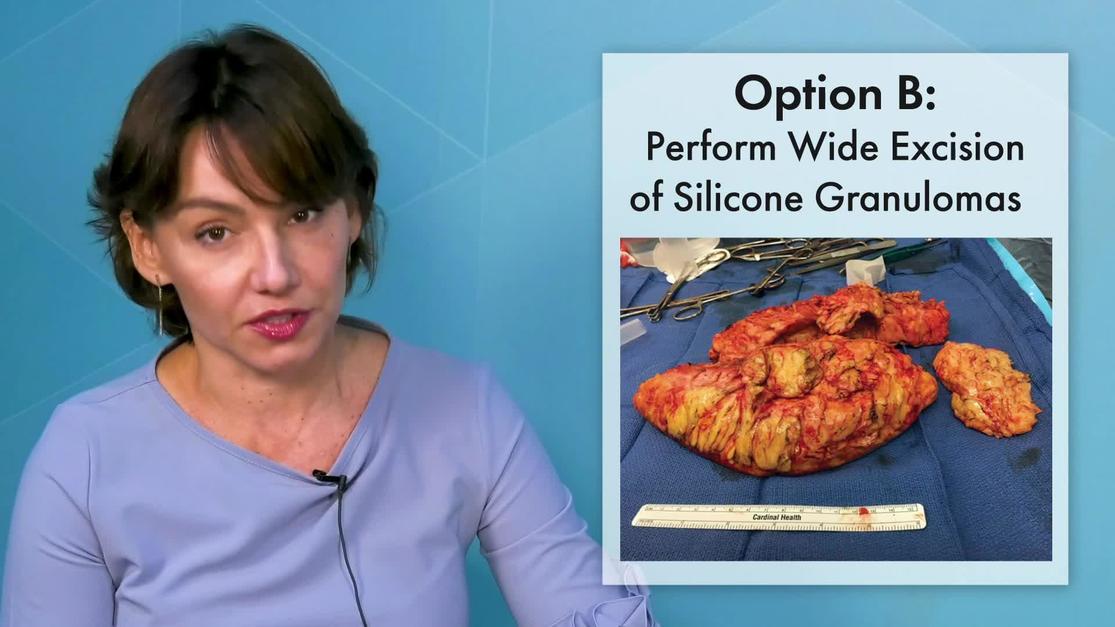 Plastic and Reconstructive Surgery Global Open