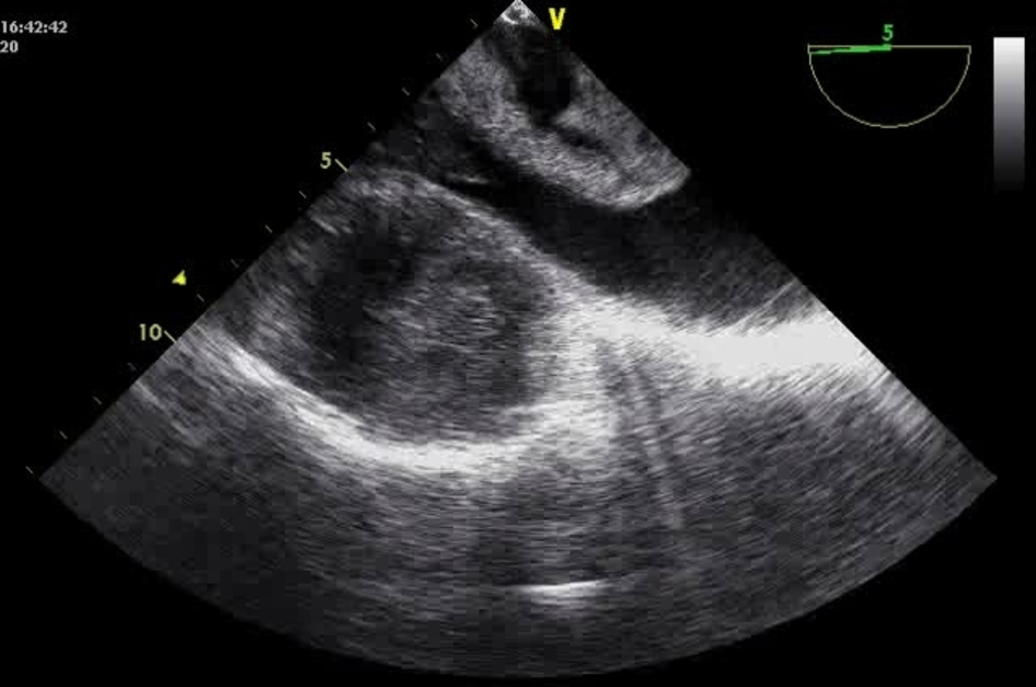 Anesthesia & Analgesia