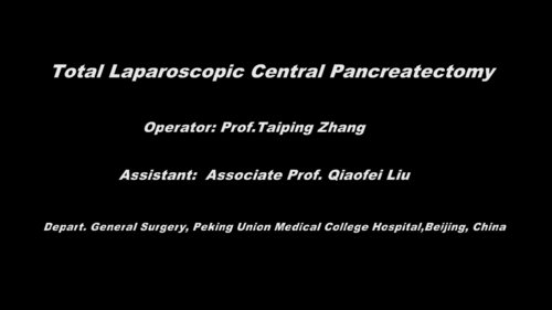 Total Laparoscopic Central Pancreatectomy
