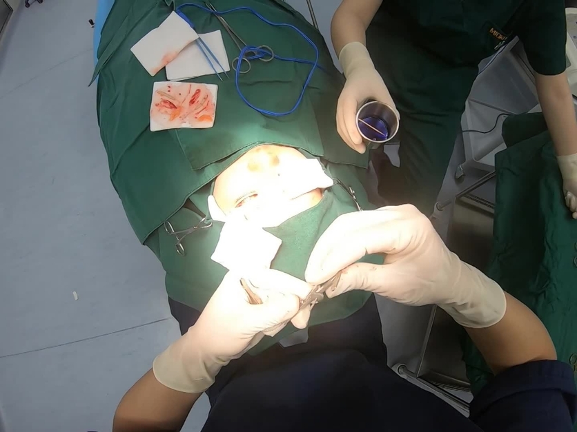 Plastic and Reconstructive Surgery – Global Open