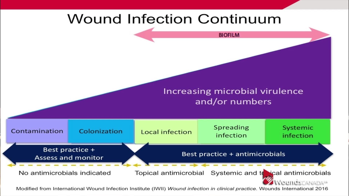 wound infection diagram