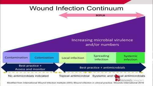 Presenting a Wound Infection Checklist