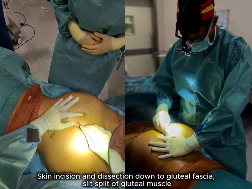 Plastic and Reconstructive Surgery – Global Open