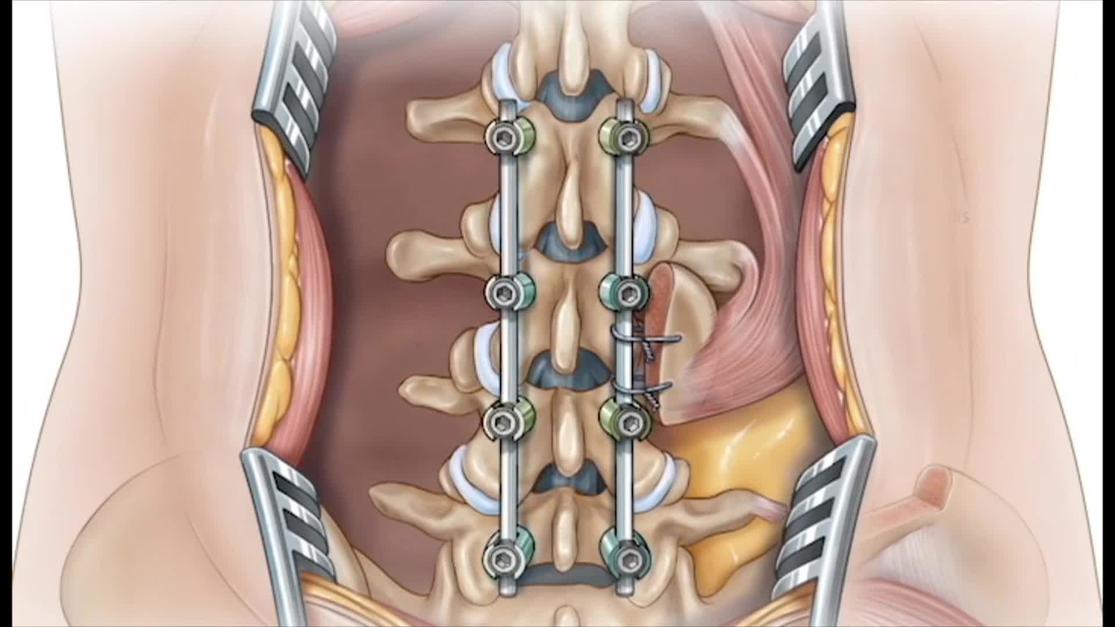 Plastic and Reconstructive Surgery – Global Open