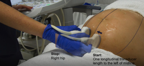 Sample representative image clips of the eight-step obstetric volume sweep imaging examination.