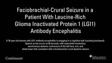 Faciobrachial-Crural Seizure in a Patient With Leucine-rich Glioma Inactivated Protein 1 (LGI1) Antibody Encephalitis