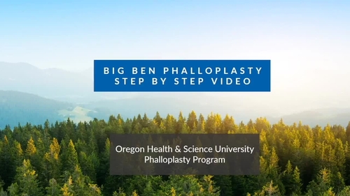 Key Steps of Big Ben Phalloplasty.  Video 1 from Big Ben Method Phalloplasty: Step by Step.