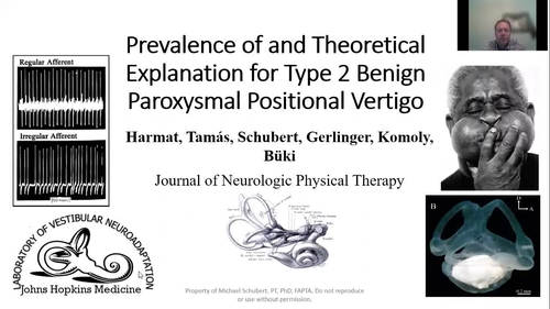 Prevalence of and Theoretical Explanation for Type 2 Benign Paroxysmal Positional Vertigo SDC 1