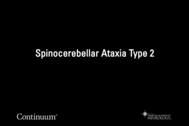 Spinocerebellar ataxia type 2
