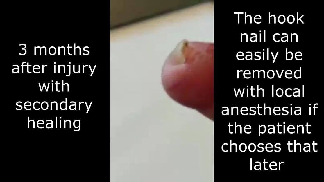 Plastic and Reconstructive Surgery Global Open