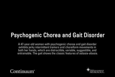 Psychogenic chorea and gait disorder