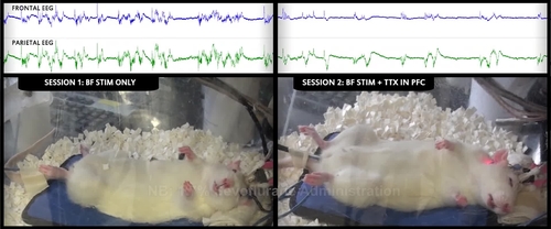 Inactivation of prefrontal cortex attenuates behavioral arousal induced by bilateral electrical stimulation of basal forebrain in sevoflurane-anesthetized rat.