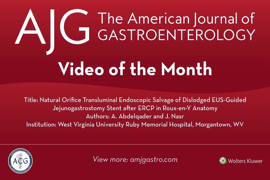 Official journal of the American College of Gastroenterology | ACG